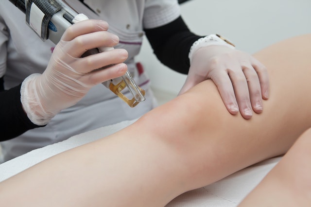 Epilation définitive
