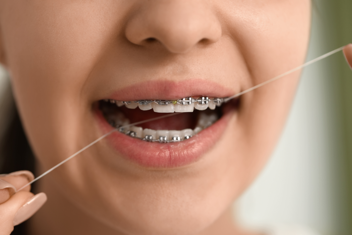 une-personne-souriante-avec-des-bijoux-dentaires-scintillants-et-des-dents-brillantes-entouree-dun-environnement-naturel-sous-une-lumiere-douce